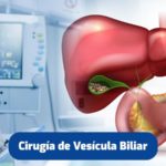 cirugia-vesicula-biliar-quito