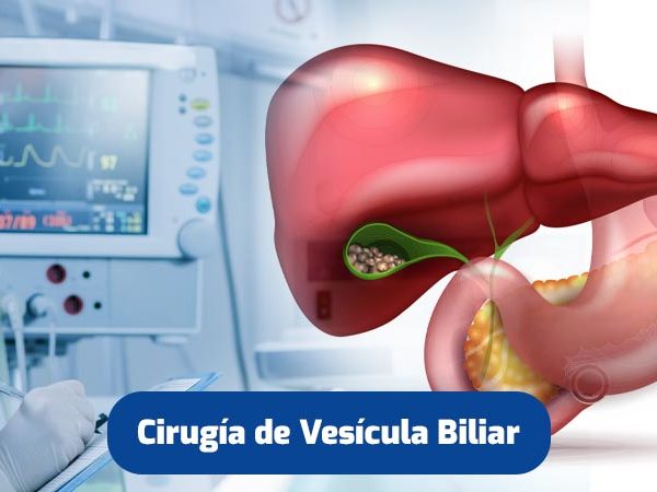 cirugia-vesicula-biliar-quito