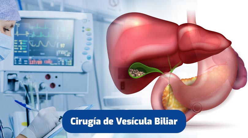 cirugia-vesicula-biliar-quito