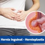 hernia-inguinal-quito