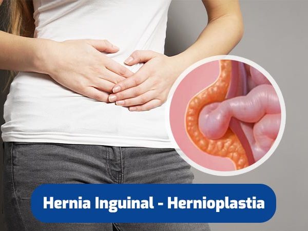 hernia-inguinal-quito