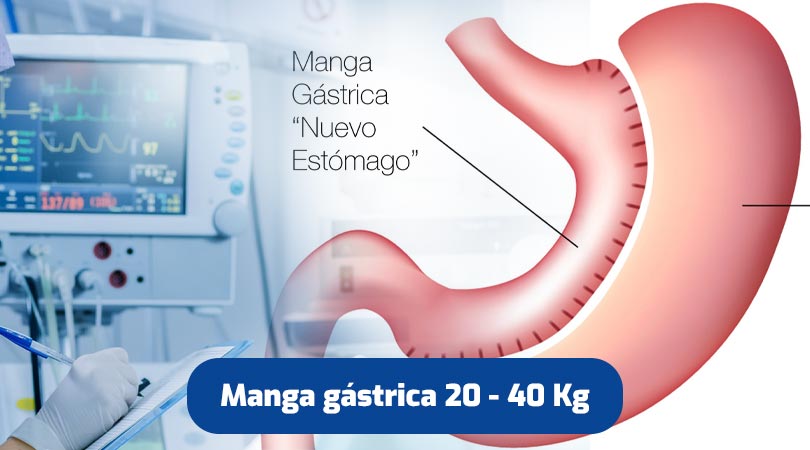 manga-gastrica-quito