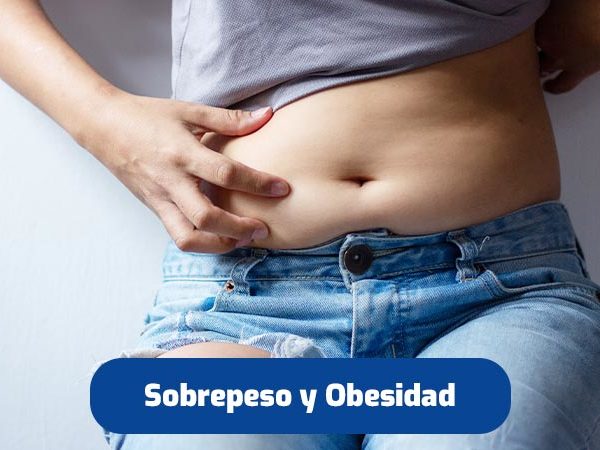 sobrepeso-y-obesidad